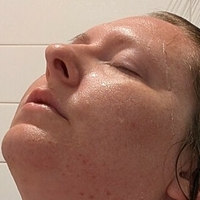 titlaser Nua